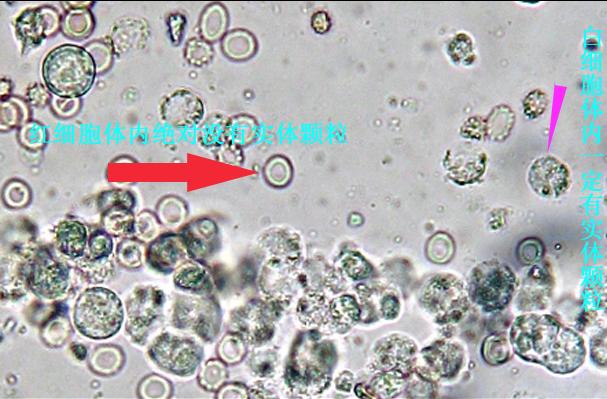 显微镜下怎么区分红白细胞图片说明